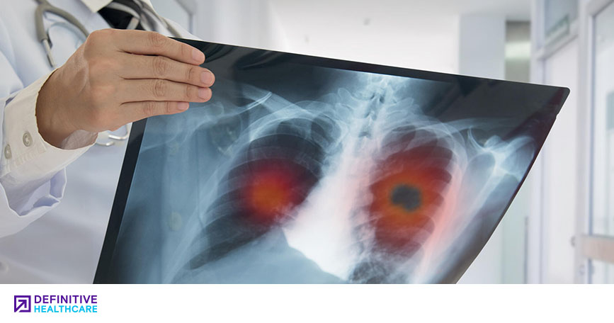 States with the Highest and Lowest COPD Readmission Rates