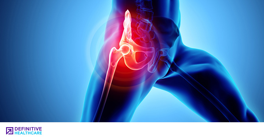 Is the Comprehensive Care for Joint Replacement (CJR) Model Working?